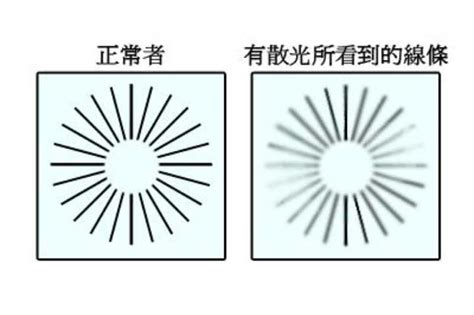 散光是怎么回事_散光症状 - 随意云