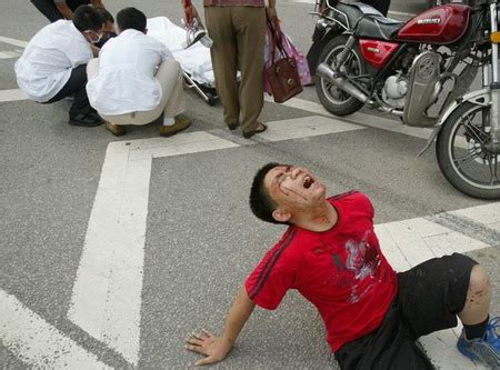 图文：车祸受伤男孩坐在地上疼得喊叫起来_新闻中心_新浪网