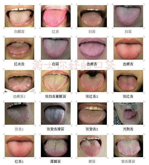 正常舌头的图片