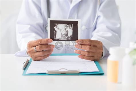 显示未出生婴儿超声波扫描高清图片下载-正版图片502553191-摄图网