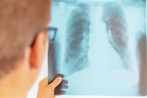 肺部有阴影一定是肺癌吗，肺部有阴影可能是哪些疾病！