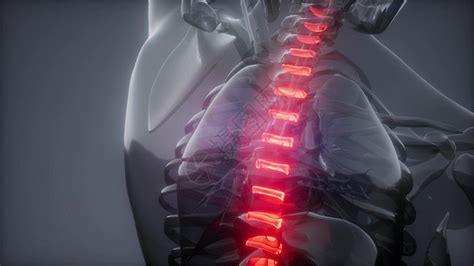 人体背部脊椎骨图片免费下载_红动网