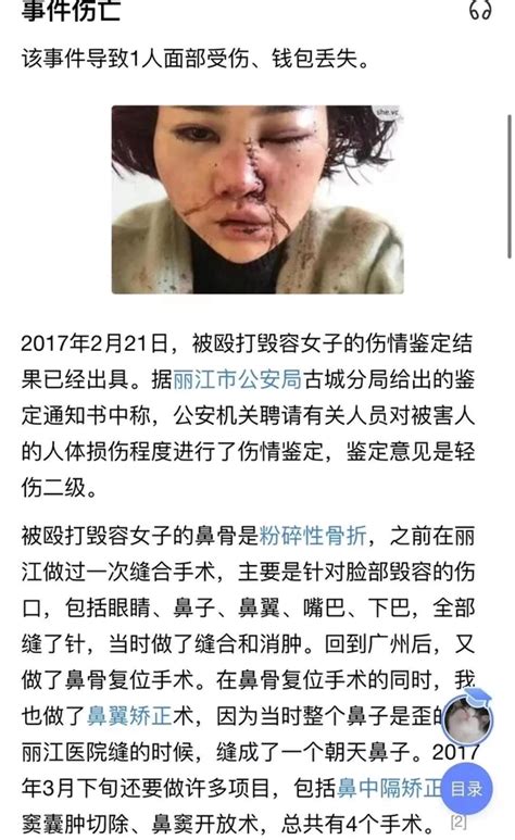忻城61岁男子与16岁少女发生关系被打 警方通报-闽南网