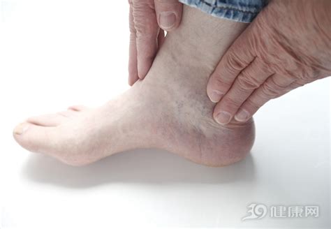 【脚踝扭伤肿了几天能好】【图】脚踝扭伤肿了几天能好 介绍几点保护脚踝不崴脚的方法(3)_伊秀健康|yxlady.com