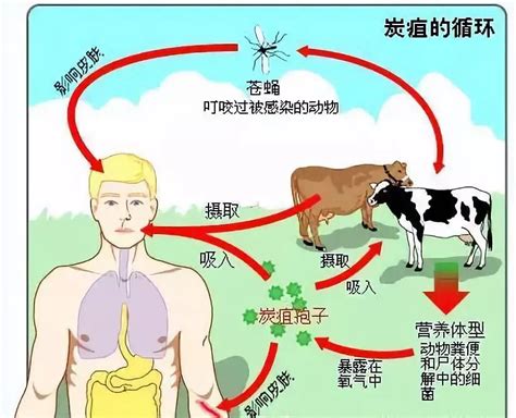 皮肤炭疽图片