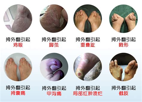 妇女脚踝受伤触摸脚疼痛运动员治疗皮肤高清图片下载-正版图片308003929-摄图网