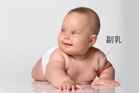 五个月的宝宝有副乳图片_39健康网_精编内容