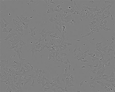 BE(2)-C细胞ATCC CRL-2268细胞 BE2C人神经母细胞瘤细胞株购买价格、培养基、培养条件、细胞图片、特征等基本信息_生物风