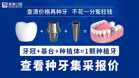 苏州种植牙||三甲牙医告诉你种植牙的品牌选择与收费！一定要看！！！！ - 知乎
