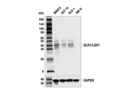 OLR1/LOX1 (E9C5A) Rabbit mAb | Cell Signaling Technology