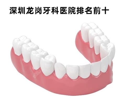 深圳龙岗看牙哪个医院好？排名前十的牙科及价格表分享,种植牙-8682赴韩整形网