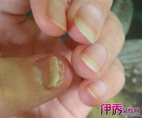 手指甲上有白点怎么办？宝宝的健康从指甲显露无疑|手指甲|指甲|维生素A_新浪新闻