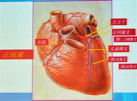 冠状动脉系统解剖、CTA解剖、分段及中英文名称对照_缩写