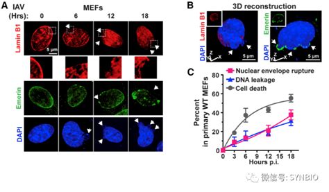 Cell+Nature+Nature|共同讲一个故事: Z型核酸激活ZBP1-RIP3-MLKL通路导致细胞程序性坏死和炎症 - 黄灿华教授 实验室