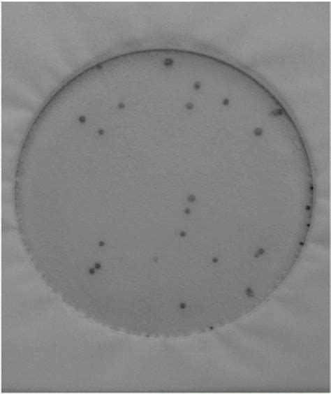 流感嗜血杆菌 BNCCBNCC337544 微生物菌种|北纳生物