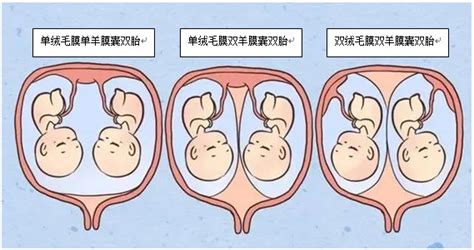 双胎、多胎和联胎_《组织学与胚胎学》_【中医宝典大全】