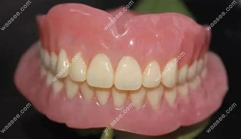 深圳福田区种植牙价格表公布：含深圳50-60岁种牙镶牙价格表 - 口腔资讯 - 牙齿矫正网