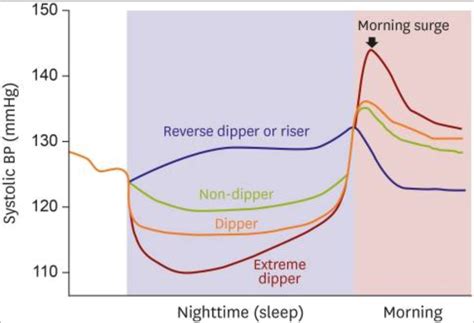 一文探析：睡眠障碍与血压的秘密丨“睡”到渠成_高血压_睡眠_医脉通