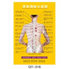 背部刮痧示意图图片