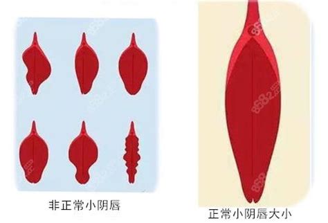 正常的阴唇图片