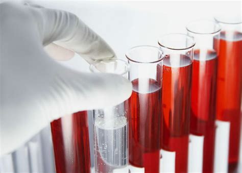 代谢组学临床血液样本分析前处理的建议