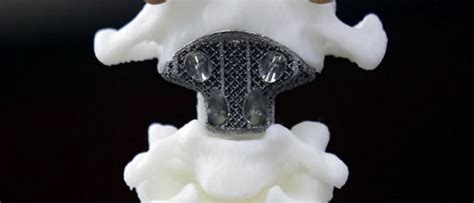 3D打印生物陶瓷人工骨支架的研究进展