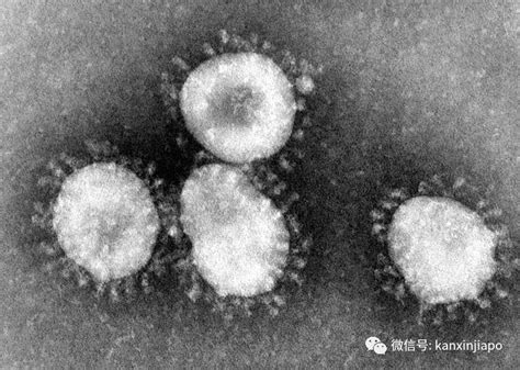 影响新冠疫情反复出现的四种可能因素_病毒