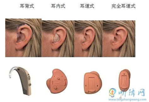 教你如何正确戴耳背式助听器? - 验配常见问题 - 助听器品牌,助听器价格,助听器排行榜-听觉有道官网