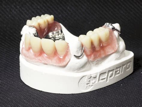 铸造支架义齿设计图谱收集（一）-李望松的博客-KQ88口腔博客