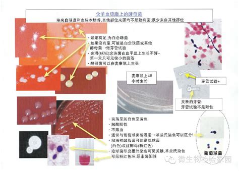 微生物检验操作过程中的注意点-江门市凯林贸易有限公司