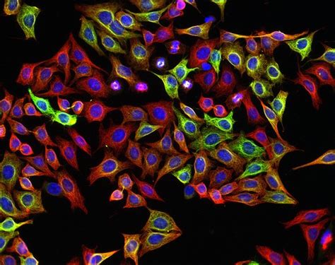 DC2.4 小鼠树突状细胞 - 大鼠与小鼠细胞 - 北京启研生物科技有限公司 官网