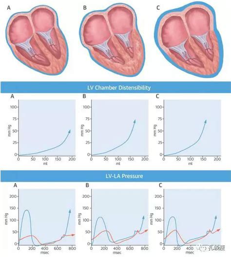心肌的生物电现象和生理特征(三) 二、心肌的电生理特性心肌组织具有兴奋性、自律性、传导性和收缩性四种生理特性。心肌的收缩性是指心肌能够在肌膜 ...