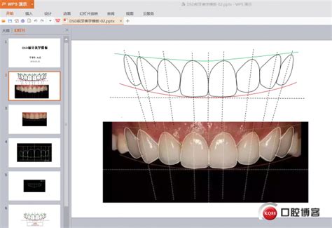 DSD前牙美学模板（于吉冬原创）-于吉冬的博客-KQ88口腔博客