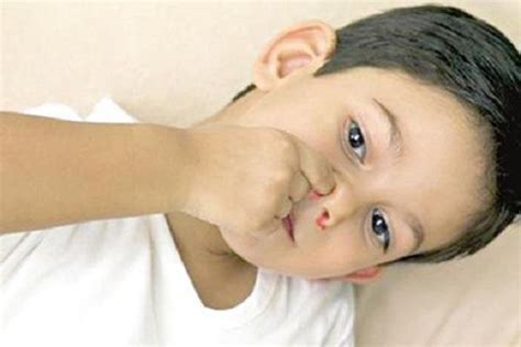 鼻子出血是什么原因?流鼻血是什么病的前兆_探秘志