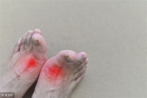 脚踝疼痛是什么原因（脚踝疼痛怎么治疗最有效） | 说明书网