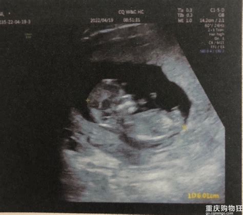 重庆市妇幼产检及费用全记录-备孕怀孕-重庆购物狂