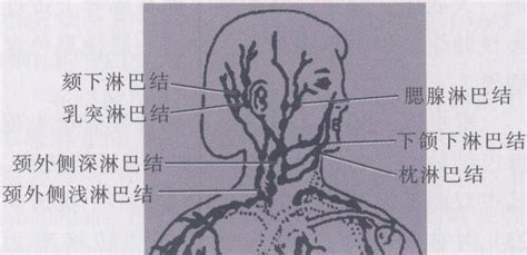 颈部淋巴结分布图图片 颈部淋巴结分布图图片