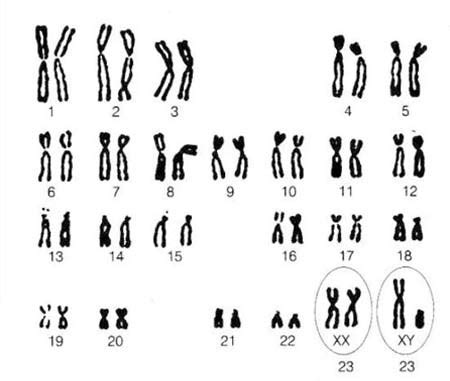 关于人类染色体核型报告解读及相关案例简述 | LRC