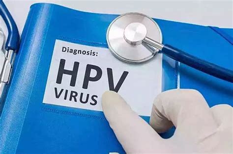 女性感染hpv病毒有什么症状-有来医生