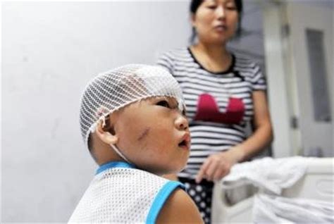 小区掉玻璃砸伤1岁男孩追踪：小孩脸上缝30针(图)_大成网_腾讯网