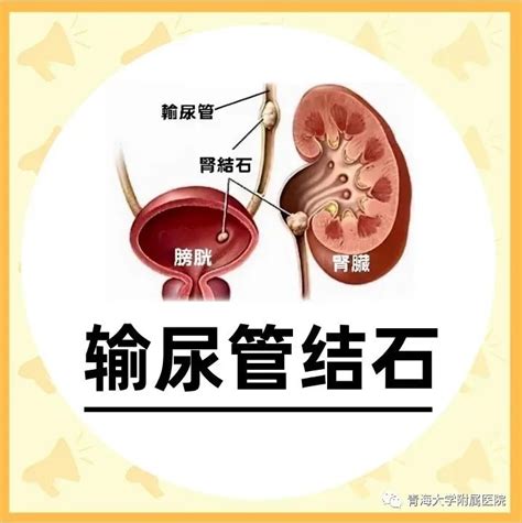 输尿管图片