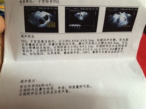 b超检验模板_怀孕一个月报告单图片 - 随意云