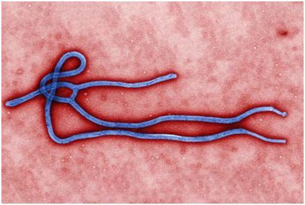 病毒之王埃博拉，令全美陷入恐慌的病毒有多可怕？ - 知乎