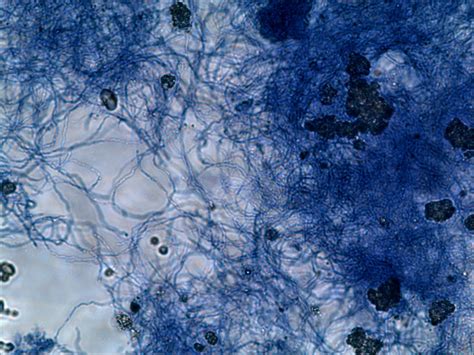 显微镜下的细菌微生物视频_1920X1080_高清视频素材下载(编号:326643)_实拍视频_VJ师网 www.vjshi.com