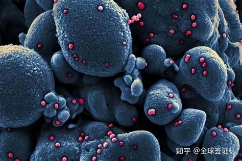 俄罗斯出现甲型H1N1流感病例，病毒反反复复何时休 - 知乎