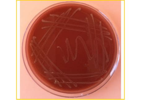 流感嗜血杆菌生化特征-微生物图片-青岛海博生物