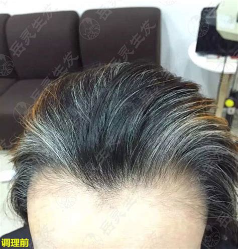 【图】白头发怎么能变黑发 10大妙招让头发迅速变黑(2)_白头发怎么能变黑_伊秀美容网|yxlady.com