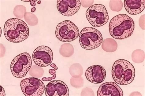 五种白细胞形态图,原始粒细胞,白细胞分类_大山谷图库