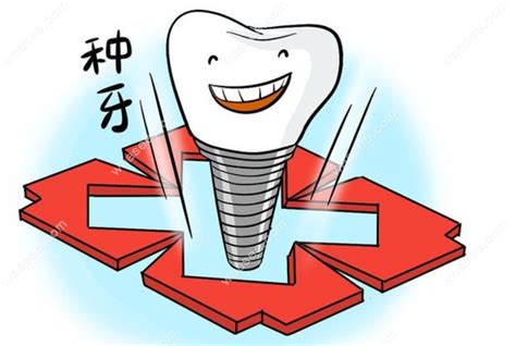 武威50-60岁种植牙价格,选韩国/欧洲植体品牌不同价格不同 - 口腔资讯 - 牙齿矫正网