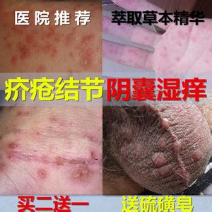 阴囊结节图片